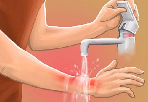 Những mẹo nhỏ khi xảy ra sự cố khi dùng bếp gas bạn nên nhớ